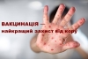 Вакцинація &ndash; найкращий захист від кору