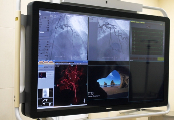 В обласній лікарні робитимуть унікальні операції на судинах